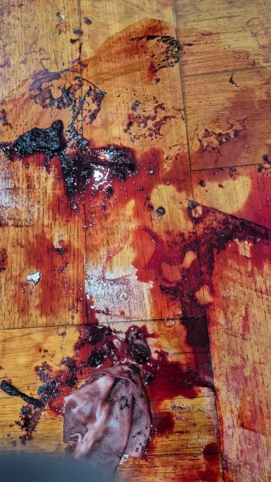 혈흔 분해 약품 반응 마루 바닥 혈액 분해 작업 중