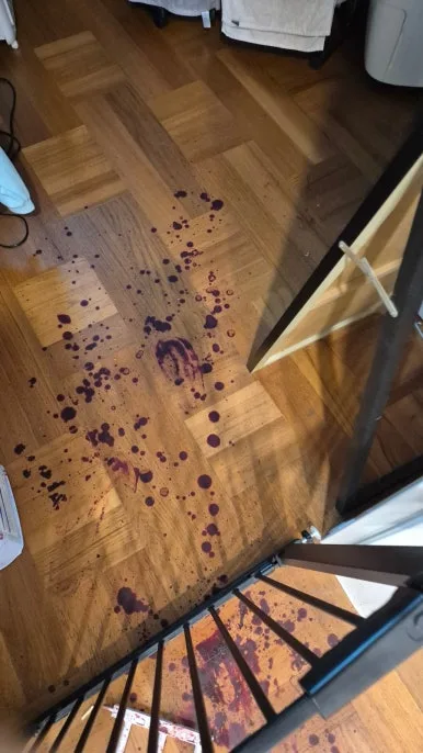 혈흔 계단 2층 바닥 오염 작업 전