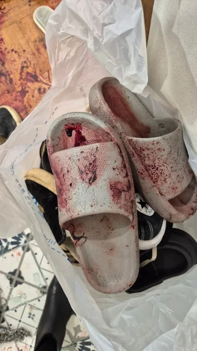 혈흔 오염 슬리퍼 신발 혈액 묻은 신발
